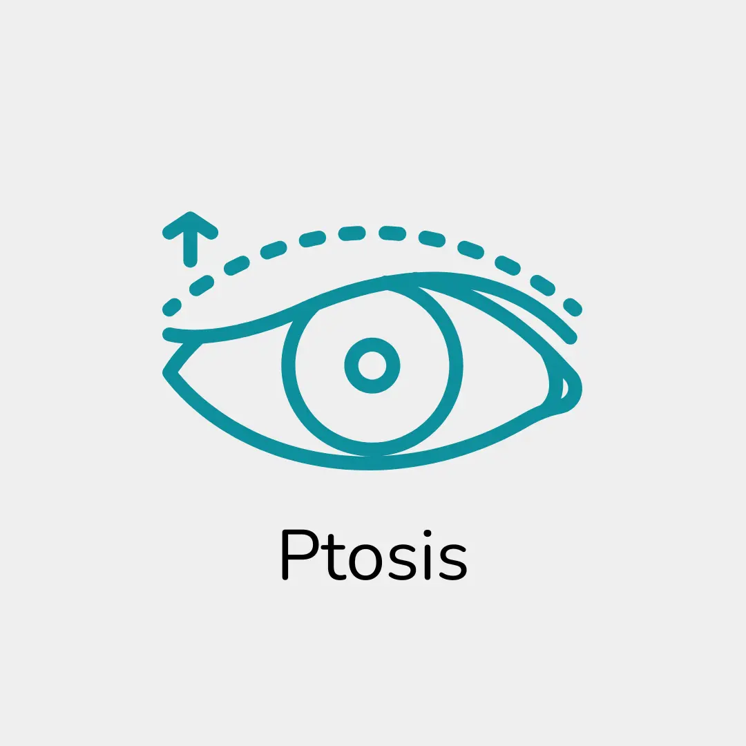 Ptosis