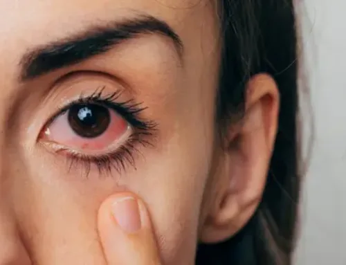 Eye Infections: Identifying Bacterial, Viral, and Fungal Causes and How to Treat Them